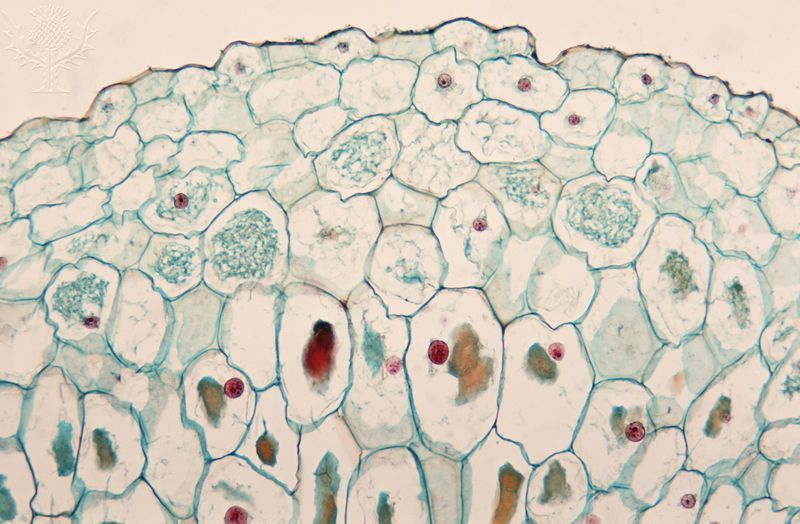 Mycorrhiza in plant root cells